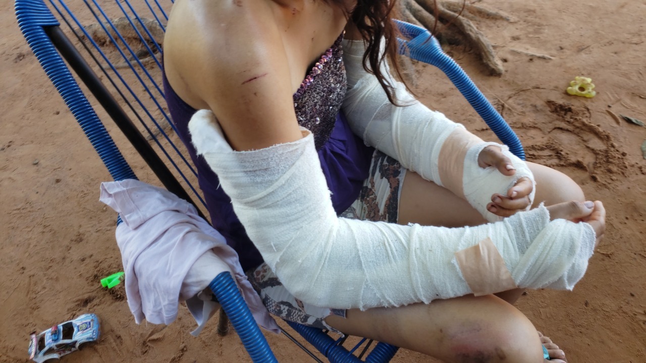 EXCLUSIVO; Habla mujer que fue brutalmente torturada por su pareja docente