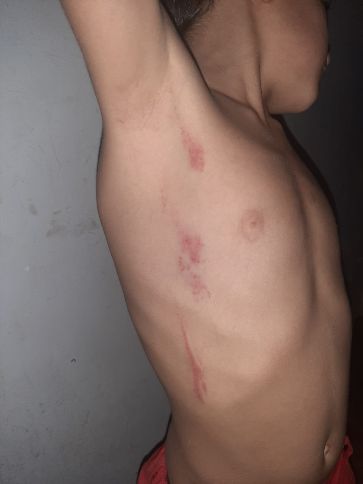 Madre es denunciada por supuestamente maltratar a su menor hijo