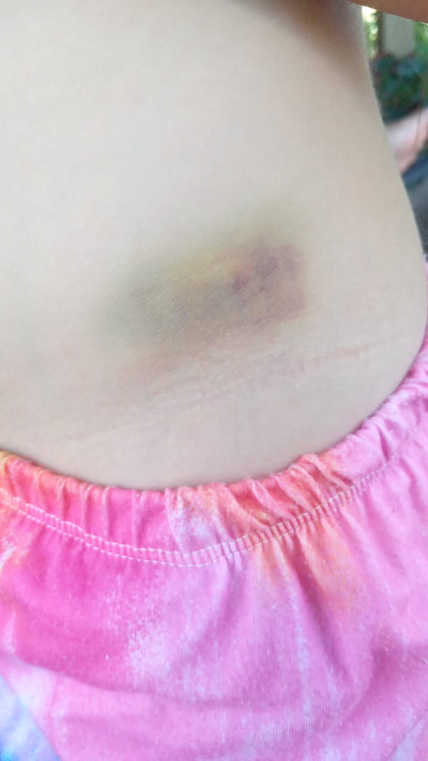 Padre y madrastra denunciados por violencia contra menor