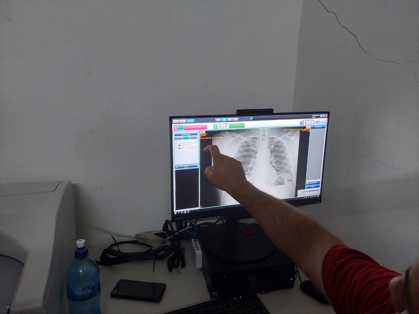 Ante de tres meses se descompone moderno equipo de radiografía del hospital de Curuguaty