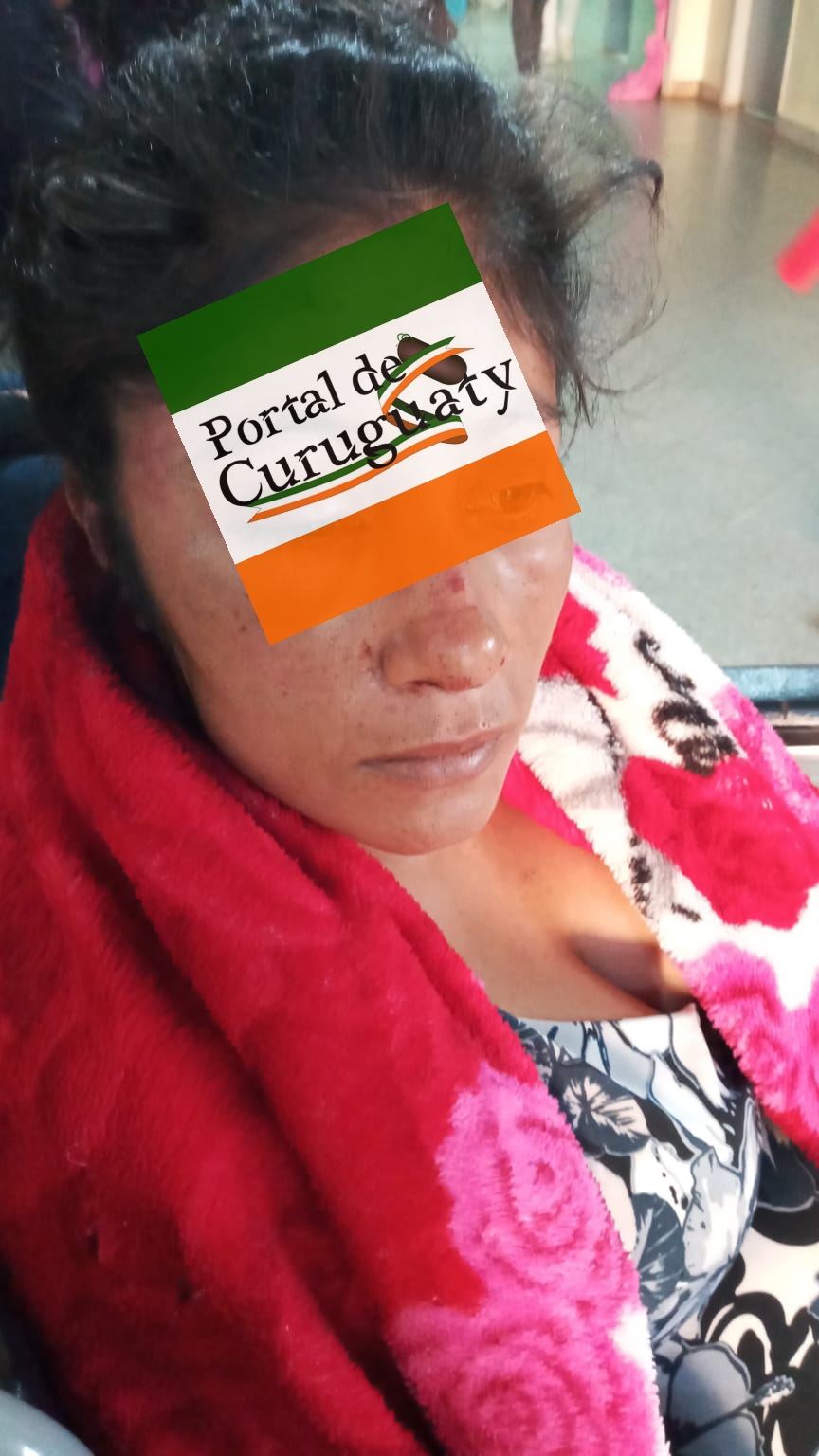 Mujer fue brutalmente golpeada por su pareja en Acepar