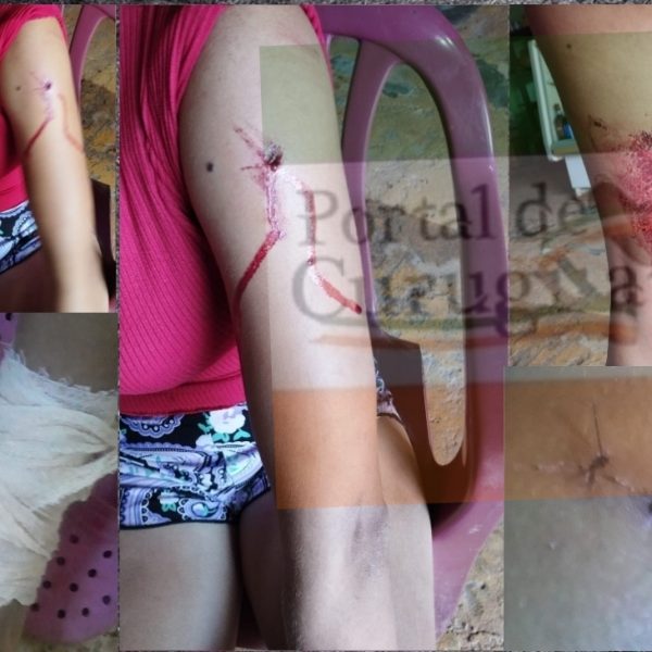 VÍDEO. Terrible violencia contra la mujer en Araujo Cué