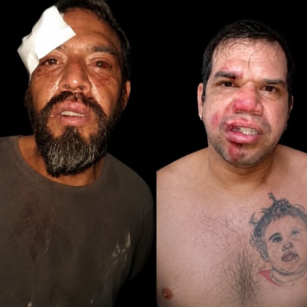 Dos policías son investigados por presunta golpiza a dos hermanos en Asunción